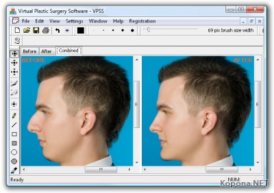 Virtual Plastic Surgery Software v1.0.0.1484